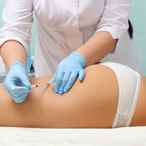 SLIMMING, Mesotherapy for cellulite